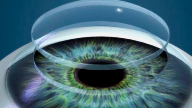 Primeras córneas humanas impresas en 3D